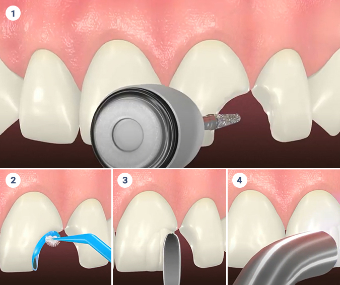 Cosmetic Dentist Near Me