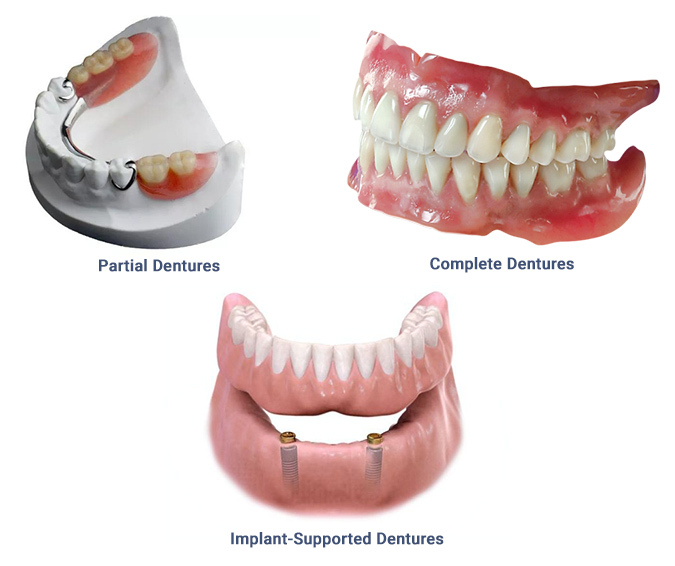 Dentures