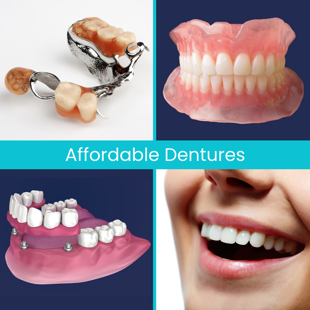 Denture Teeth Repair & Broken Denture Tooth Repair | Denture Repair Lab