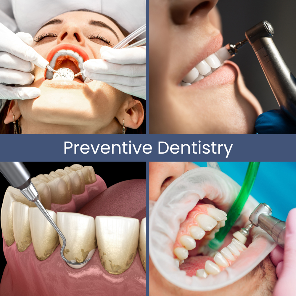 Preventive Dentistry Rockville Centre, NY South Nassau Dental Arts