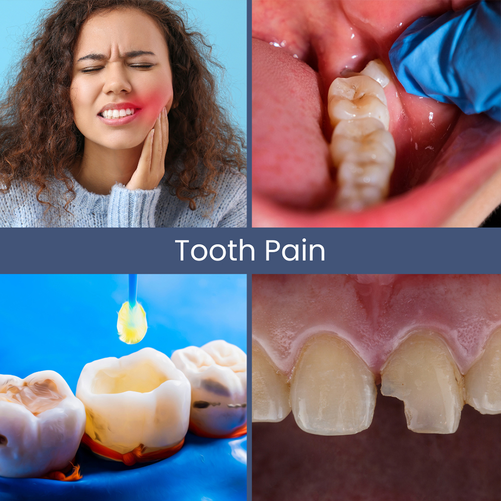 Tooth Pain Relief Rockville Centre Tooth Pain After Filling