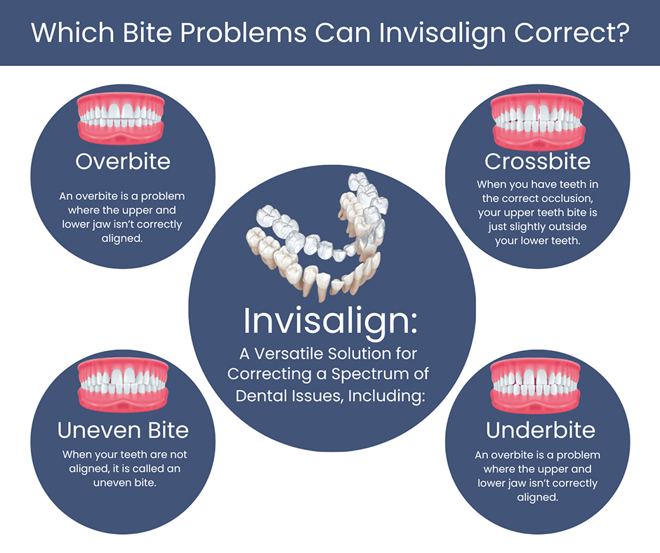Which Bite Problems Can Invisalign Correct